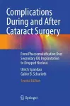 Complications During and After Cataract Surgery cover