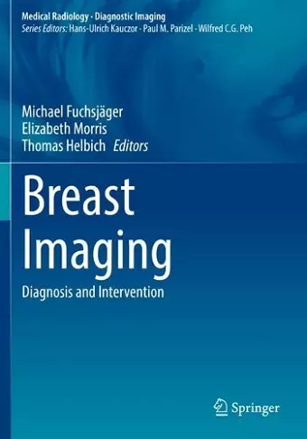 Breast Imaging cover