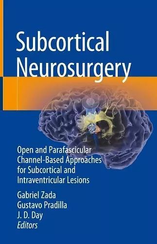 Subcortical Neurosurgery cover