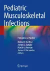 Pediatric Musculoskeletal Infections cover