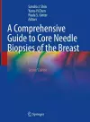 A Comprehensive Guide to Core Needle Biopsies of the Breast cover