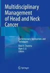 Multidisciplinary Management of Head and Neck Cancer cover