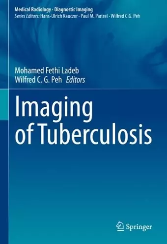 Imaging of Tuberculosis cover