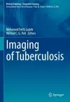 Imaging of Tuberculosis cover