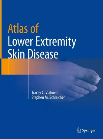 Atlas of Lower Extremity Skin Disease cover