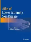 Atlas of Lower Extremity Skin Disease cover