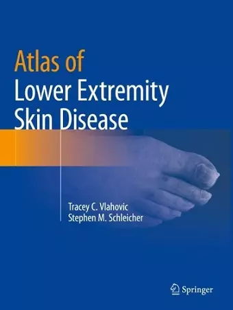 Atlas of Lower Extremity Skin Disease cover