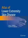 Atlas of Lower Extremity Skin Disease cover