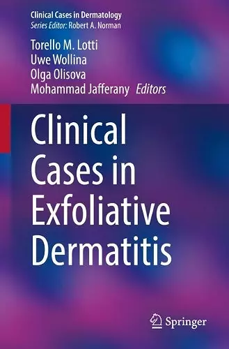 Clinical Cases in Exfoliative Dermatitis cover