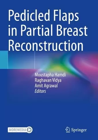 Pedicled Flaps in Partial Breast Reconstruction cover
