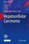 Hepatocellular Carcinoma cover