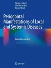 Periodontal Manifestations of Local and Systemic Diseases cover