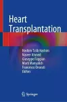 Heart Transplantation cover