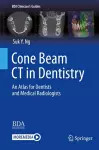 Cone Beam CT in Dentistry cover