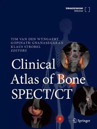 Clinical Atlas of Bone SPECT/CT cover