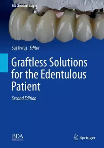 Graftless Solutions for the Edentulous Patient cover