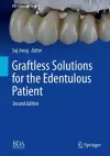 Graftless Solutions for the Edentulous Patient cover