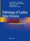 Pathology of Cardiac Valve Disease cover