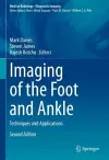 Imaging of the Foot and Ankle cover