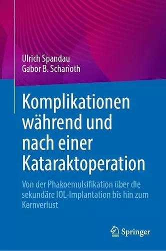 Komplikationen während und nach einer Kataraktoperation cover