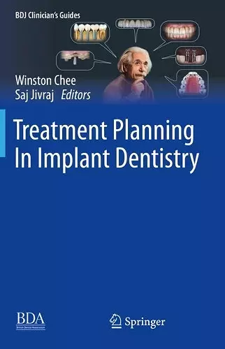 Treatment Planning In Implant Dentistry cover