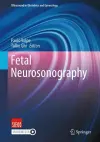 Fetal Neurosonography cover