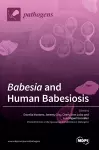 Babesia and Human Babesiosis cover
