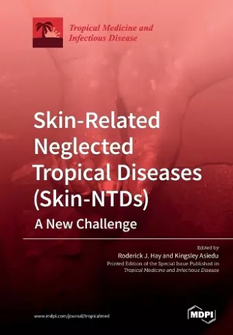 Skin-Related Neglected Tropical Diseases (Skin-NTDs) A New Challenge cover