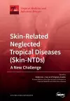 Skin-Related Neglected Tropical Diseases (Skin-NTDs) A New Challenge cover