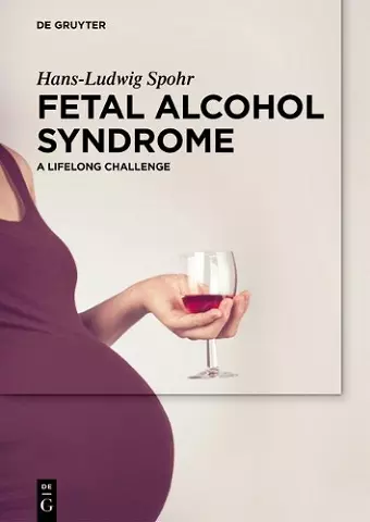 Fetal Alcohol Syndrome cover