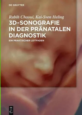 3D-Sonografie in der pränatalen Diagnostik cover