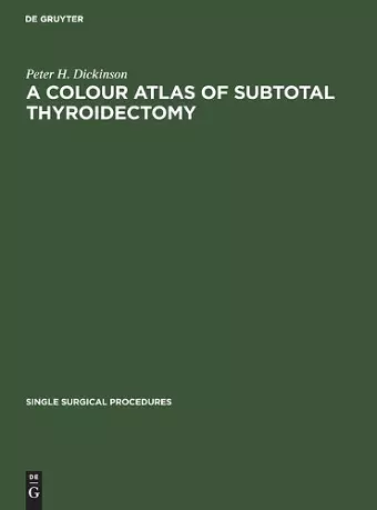 A Colour Atlas of Subtotal Thyroidectomy cover