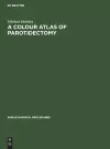 A Colour Atlas of Parotidectomy cover