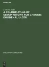 A Colour Atlas of Seromyotomy for Chronic Duodenal Ulcer cover