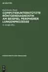 Computerunterstützte Röntgendiagnostik Am Beispiel Peripherer Lungenprozesse cover