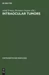 Intraocular Tumors cover