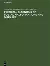 Prenatal Diagnosis of Foetal Malformations and Diseases cover