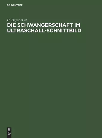 Die Schwangerschaft Im Ultraschall-Schnittbild cover