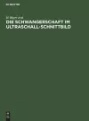 Die Schwangerschaft Im Ultraschall-Schnittbild cover