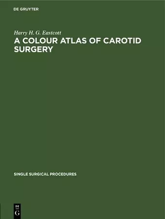 A Colour Atlas of Carotid Surgery cover