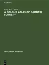 A Colour Atlas of Carotid Surgery cover
