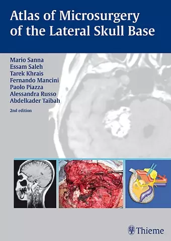 Atlas of Microsurgery of the Lateral Skull Base cover