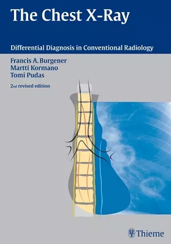 The Chest X-Ray cover