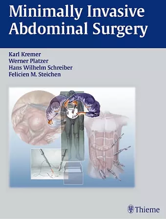 Minimally Invasive Abdominal Surgery cover