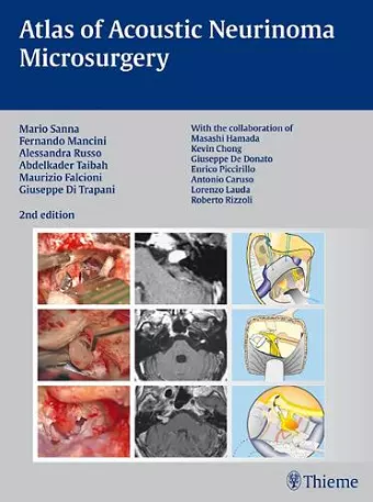 Atlas of Acoustic Neurinoma Microsurgery cover