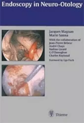 Endoscopy in Neuro-Otology and Skull Base Surgery (AT) cover