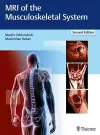 MRI of the Musculoskeletal System cover