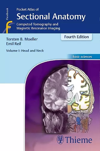 Pocket Atlas of Sectional Anatomy, Volume I: Head and Neck cover