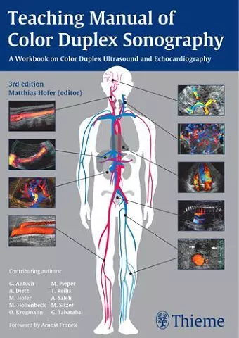 Teaching Manual of Color Duplex Sonography cover