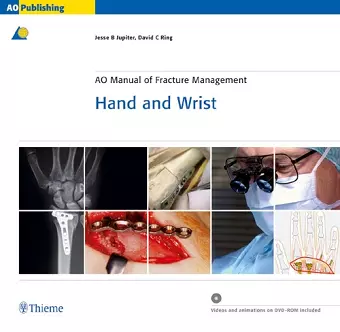 AO Manual of Fracture Management - Hand and Wrist cover